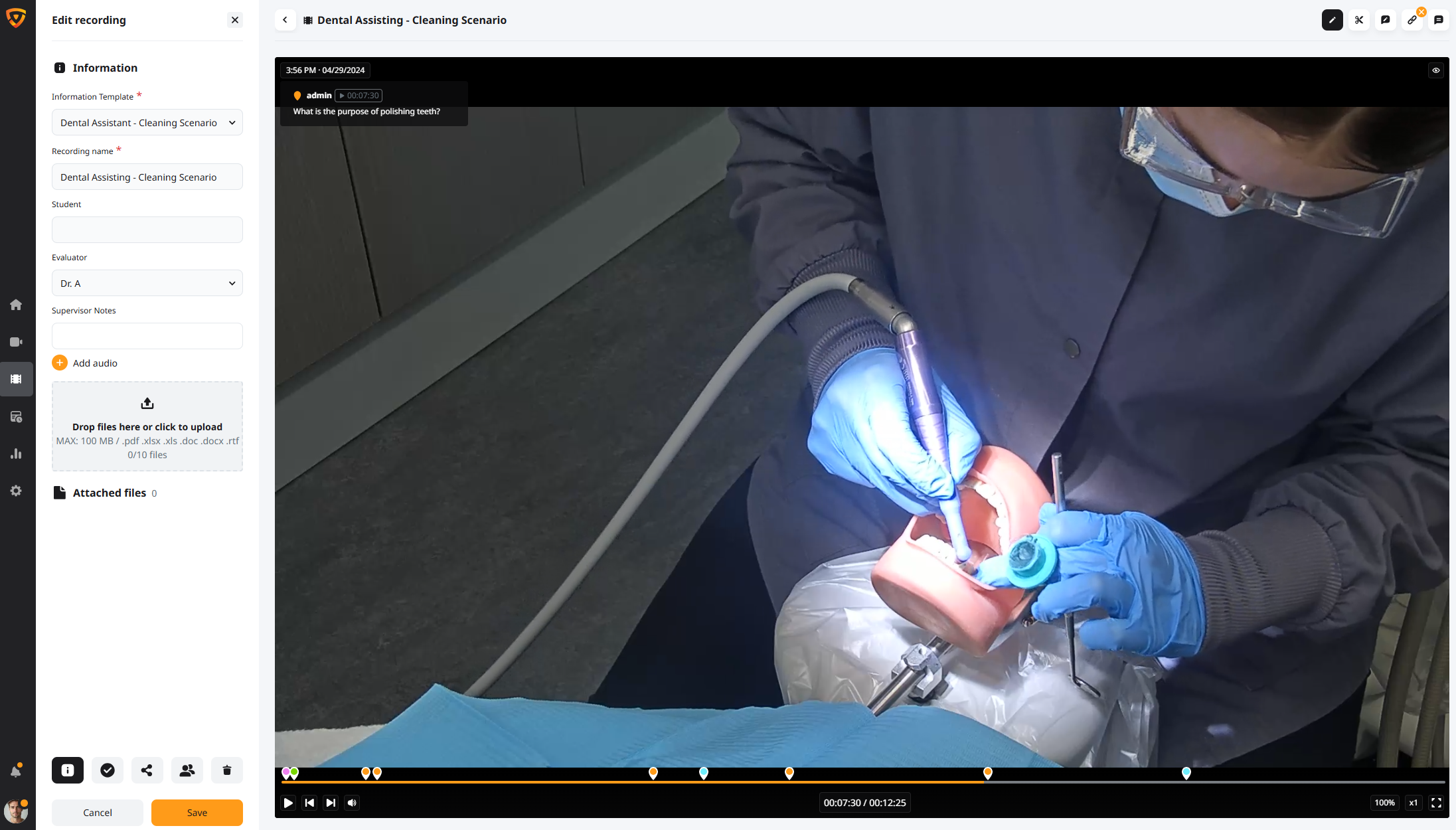 dental information valt