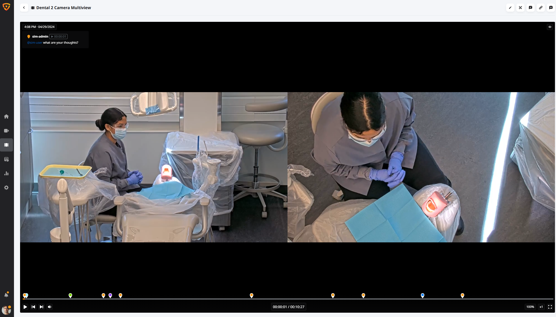 dental observe valt